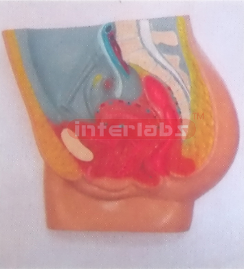 HUMAN PRIMARY FEMALE HEALTH ABDOMINAL CAVITY MODEL PLAT-TYPE, HANGING